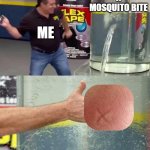 Iykyk | A MOSQUITO BITE; ME | image tagged in flex tape,memes | made w/ Imgflip meme maker