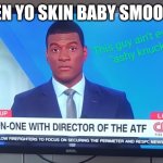 ASHY KNUCKLES | WHEN YO SKIN BABY SMOOOVE | image tagged in ashy knuckles | made w/ Imgflip meme maker