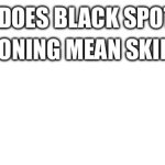 Blank | GUYS DOES BLACK SPOTS ON; SUN POISONING MEAN SKIN CANCER? | image tagged in blank | made w/ Imgflip meme maker