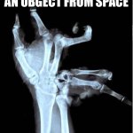 :l | POV YOU CATCH AN OBGECT FROM SPACE | image tagged in broken hand | made w/ Imgflip meme maker