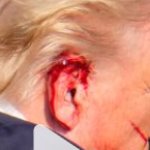 Trump bloody ear assassination
