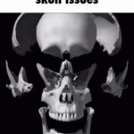 Skull issue