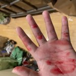 Bloody hand