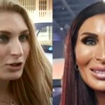 Laura Loomer Before and After plastic surgery