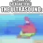 real | MY BABY IS SO BEAUTIFUL! THE ULTRASOUND: | image tagged in gifs,memes | made w/ Imgflip video-to-gif maker