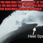 A Real Heel | THE MAN WAS TOO “DISABLED” AT 18 FOR THE MILITARY BUT YOU PEOPLE BELIEVE HE’S “THE HEALTHIEST MAN IN THE WORLD” AT 78. | image tagged in bone spur,trump | made w/ Imgflip meme maker