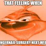 real | THAT FEELING WHEN; FINGERNAIL SURGERY NEXT WEEK | image tagged in the orange grinch | made w/ Imgflip meme maker