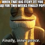 Does anyone else find this satisfying? | WHEN THAT BIG ITCHY ZIT YOU HAD FOR TWO WEEKS FINALLY POPS | image tagged in finally inner peace,memes,funny,pop,ahhhhh,oh wow are you actually reading these tags | made w/ Imgflip meme maker