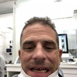 Hunter Biden Teeth | MASKS DON'T WORK!!! | image tagged in hunter biden teeth | made w/ Imgflip meme maker