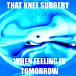 knee surgery meme