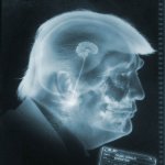 Trump brain moron Republican stupid x-ray JPP