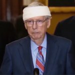 Mitch McConnell Head Bandage