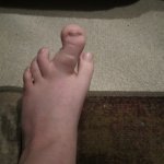 mutated toe template