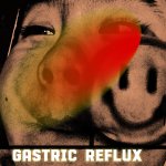 Gastric reflux meme