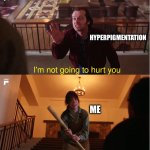 Not going to hurt you | HYPERPIGMENTATION; ME | image tagged in not going to hurt you | made w/ Imgflip meme maker