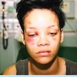 Rihanna - beaten