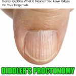 Funny | DIDDLER'S PROCTONOMY | image tagged in funny,diddy,proctologist,testing,funny kids test answers,tests | made w/ Imgflip meme maker