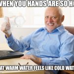 My hands are steaming. This is fine. | WHEN YOU HANDS ARE SO HOT; THAT WARM WATER FEELS LIKE COLD WATER | image tagged in hide the pain harold,steam,hands,idk | made w/ Imgflip meme maker