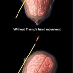 trump head movement