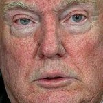 Donald Trump, scabby, blotchy, stupid
