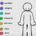 Where is your pain?