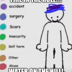 Fire in the hole!!! | FIRE IN THE HOLE!!! WATER ON THE HILL! | image tagged in pain placement chart | made w/ Imgflip meme maker