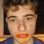 insanely sick man