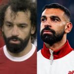 salah hairline evolution