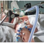 Life Support