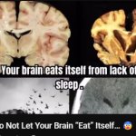 brain