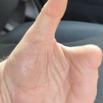 Thumbs up