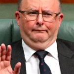 Anthony Albanese