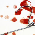 Abortion coat hangar dead women misogyny coercion fetus pro-life