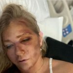 Virginia Giuffre hit by bus template