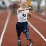 Pistorius legs kid