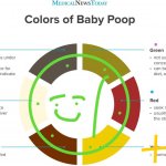 Colors Of Baby Poop