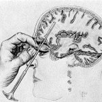 Lobotomy meme