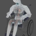 Minos in a wheelchair