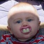 Baby with big teeth