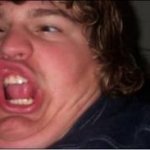 Mouth breather