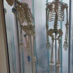 Skeleton down