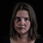 Abused wife black eye swollen lip