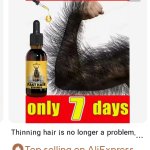 The king of hair growth