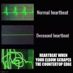 OH NO | HEARTBEAT WHEN YOUR ELBOW SCRAPES THE COUNTERTOP EDGE | image tagged in heartbeat rate | made w/ Imgflip meme maker