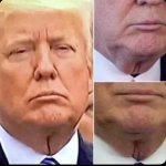 trump Neck pussy