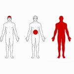pain diagram clean