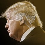 Trump, with the place outlined that his brain ought to be.