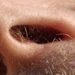 Nose hair