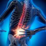 Back pain template