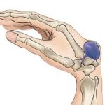 ganglion